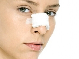 Tipos de rinoplastia