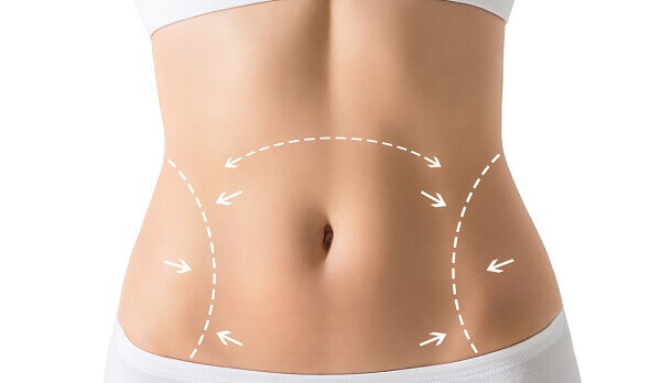 Tudo-sobre-abdominoplastia