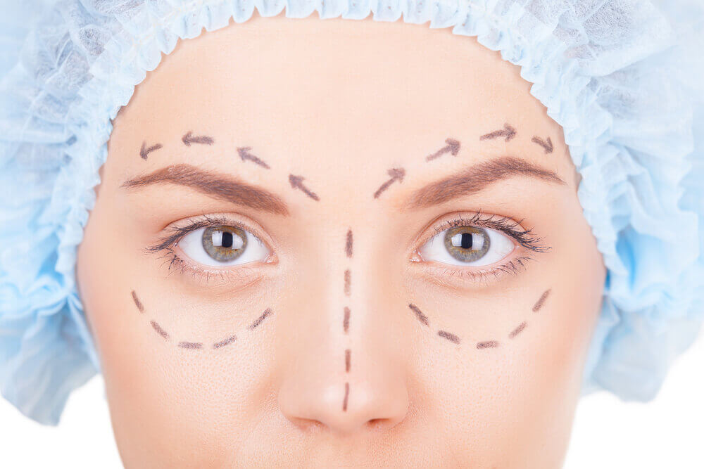 Blefaroplastiia