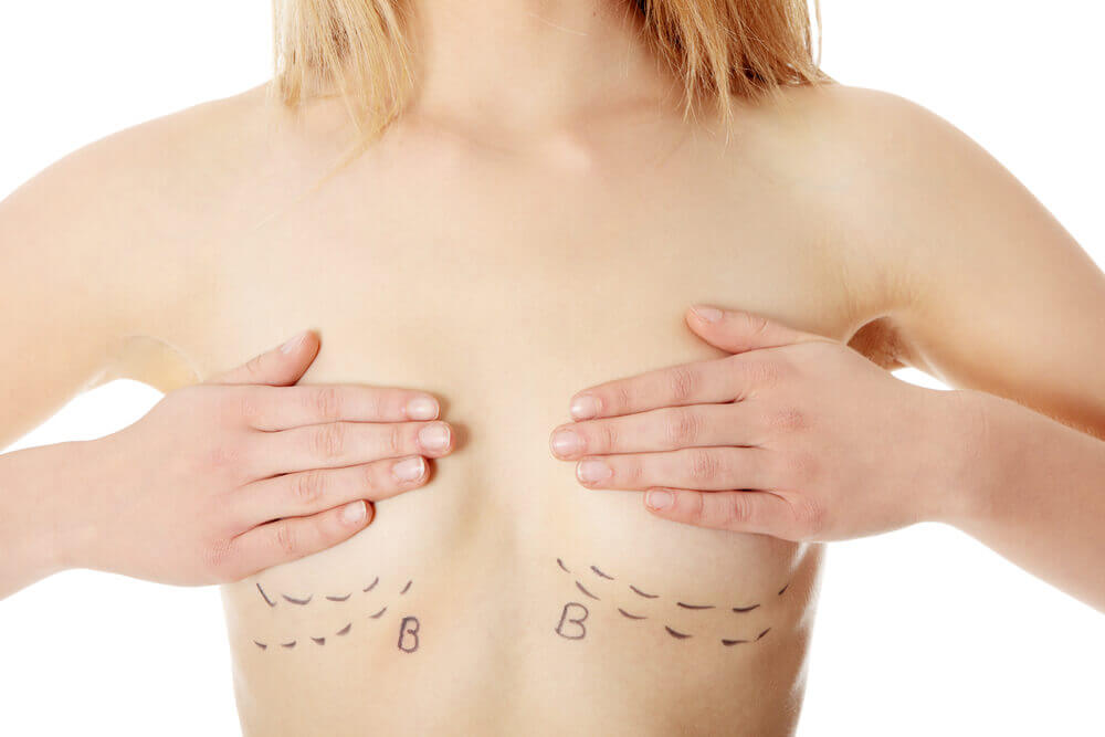 mamoplastia de aumento