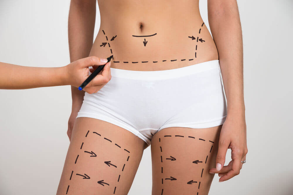 cirurgia reparadora pos bariatrica