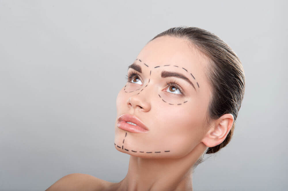 perfiloplastia