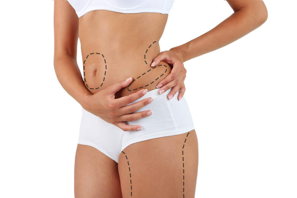quando a lipoaspiracao e indicada