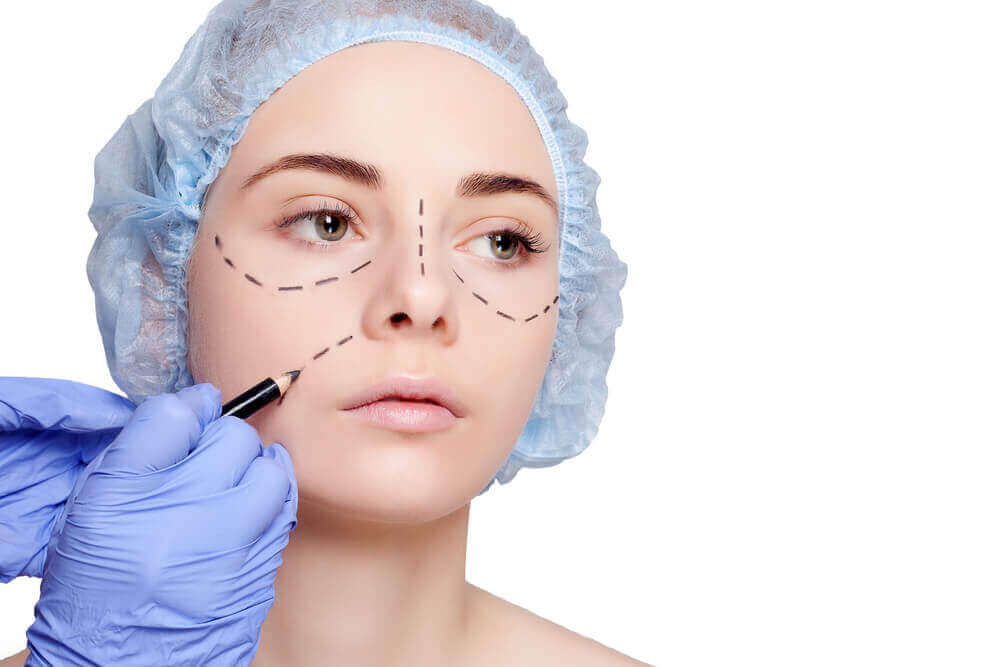 Como é o procedimento de Ritidoplastia, ou lifting facial