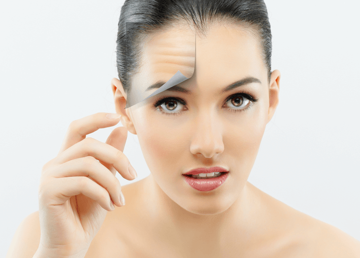 orientações do antes e depois da aplicação de Botox