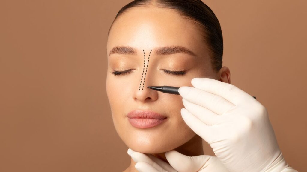 Cirurgião plástico fazendo marcações no nariz da paciente, representando a rinoplastia fechada e aberta.