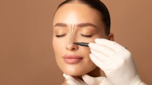Cirurgião plástico fazendo marcações no nariz da paciente, representando a rinoplastia fechada e aberta.