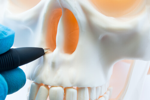 septoplastia