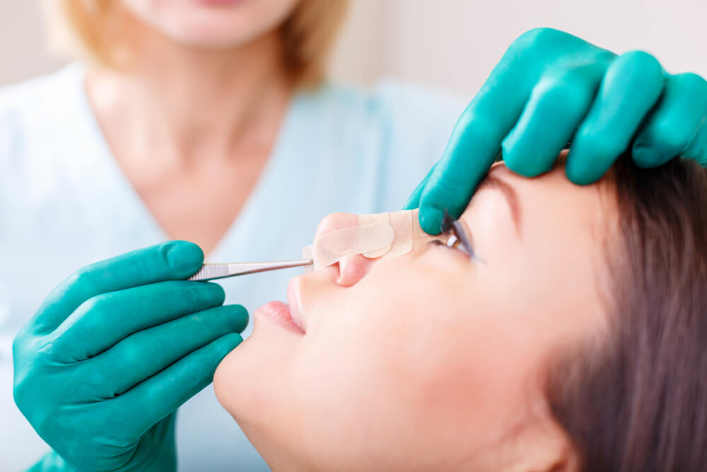 Anestesia Rinoplastia