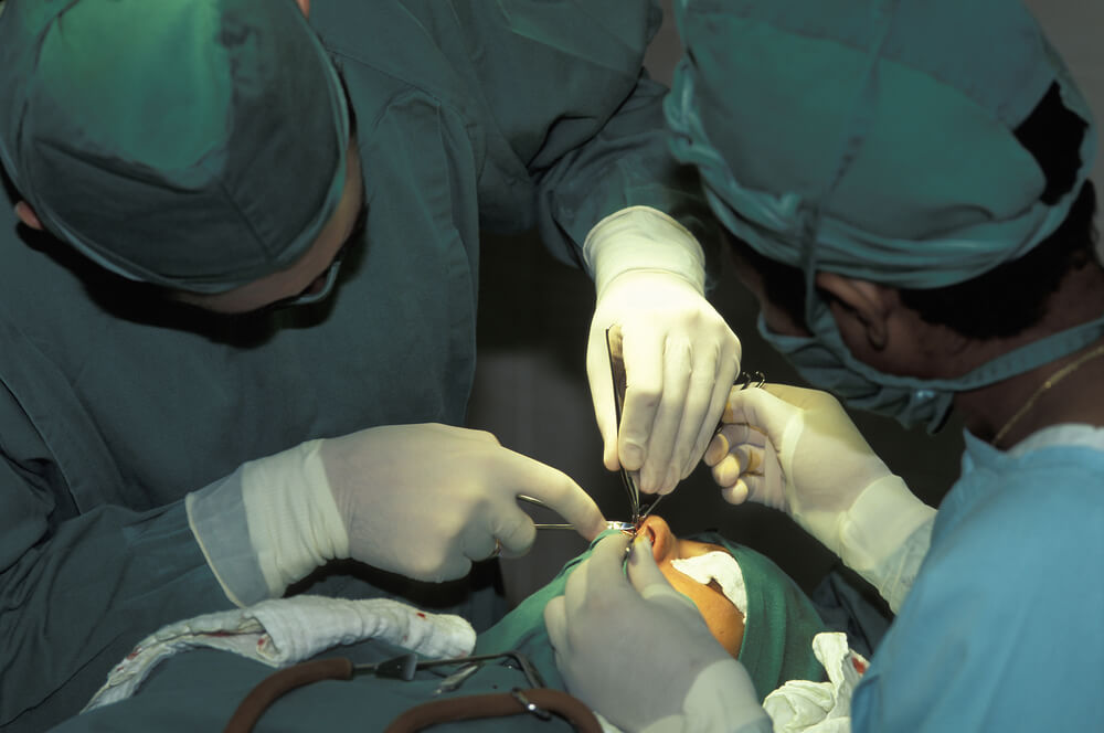Principais dúvidas sobre cirurgia de desvio de septo