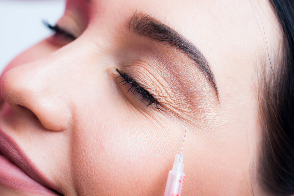 Quais os benefícios da aplicação do Botox®?