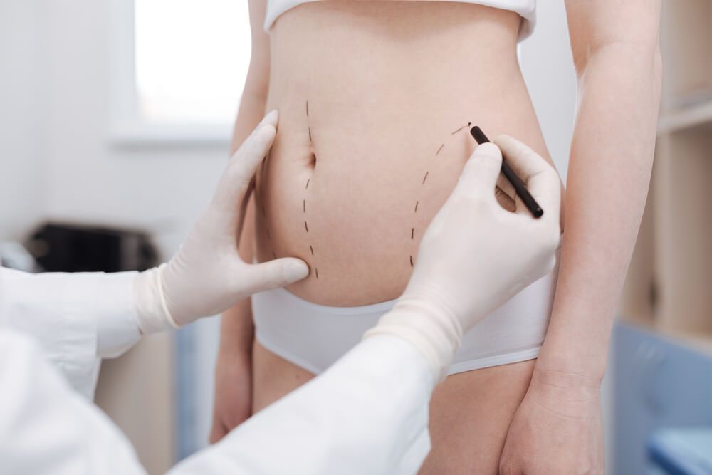 Quanto custa uma abdominoplastia