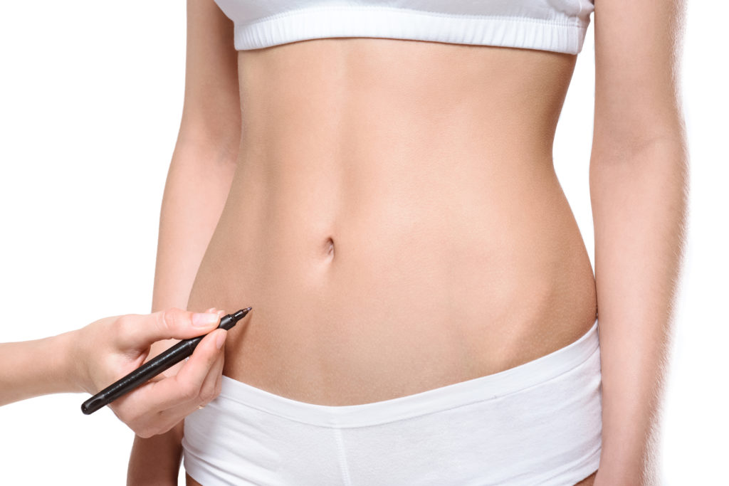 Pos operatorio Lipo