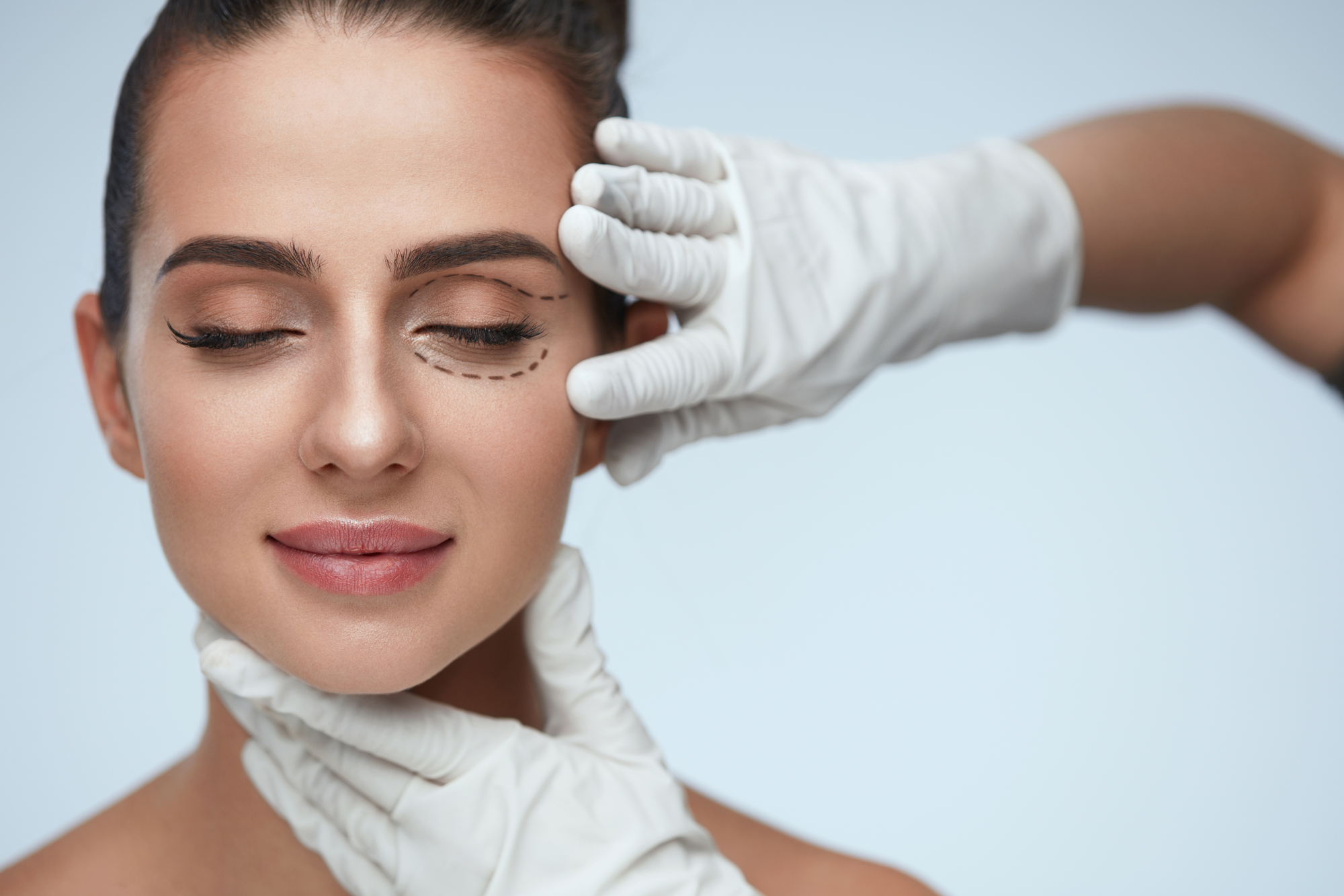 Procedimento Blefaroplastia