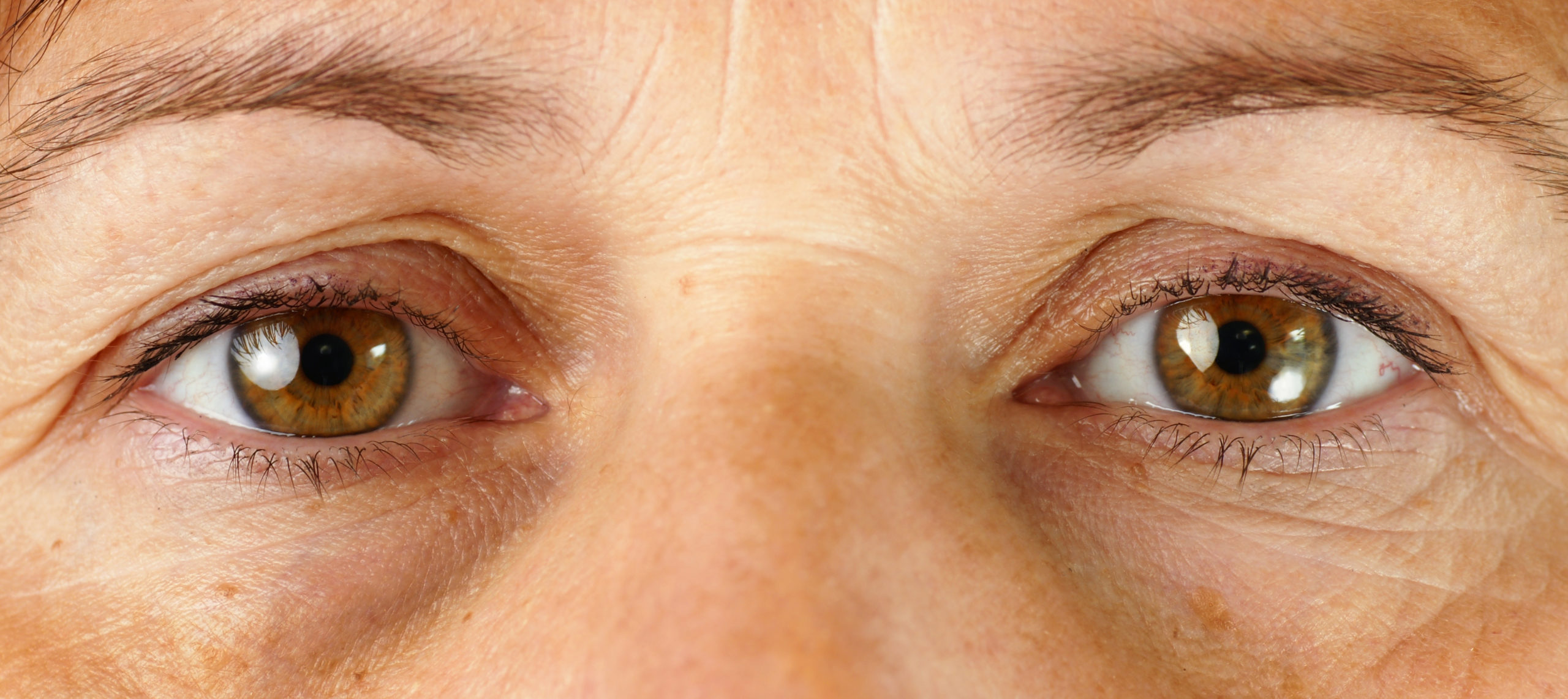 Very tired eyes
