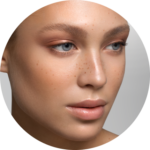 Rinoplastia Preservadora