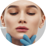 Preenchimento labial com Ácido Hialurônico