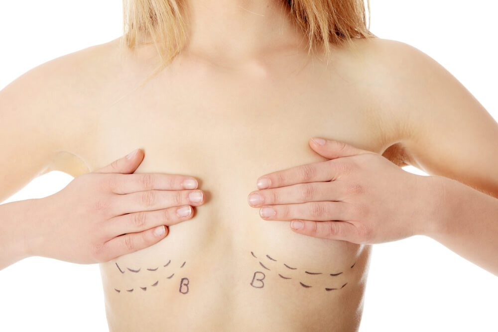 Tudo sobre mamoplastia