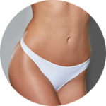 Abdominoplastia