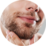 Mentoplastia
