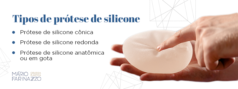 Tipos de prótose de silicone

Prótose de silicone cônica
Prótose de silicone redonda
Prótose de silicone anatômica ou em gota