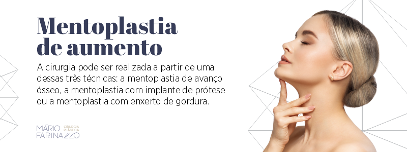 Mentoplastia de aumento. 
A cirurgia pode ser realizada a partir de uma dessas três técnicas: a mentoplastia de avanço ósseo, a mentoplastia com implante de prótese ou a mentoplastia com enxerto de gordura.