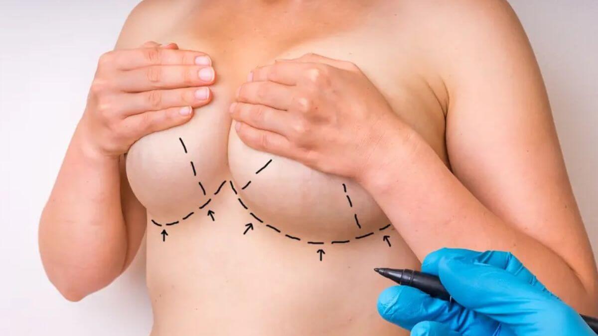 Mulher segurando os seios enquanto médico faz avaliação