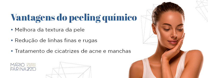 Vantagens do peeling químico: melhora da textura da pele, redução de linhas finas e rugas 
e tratamento de cicatrizes de acne e manchas.