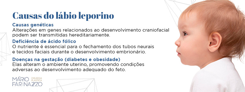 Causas do lábio leporino: Causas genéticas: alterações em genes relacionados ao desenvolvimento craniofacial podem ser transmitidas hereditariamente. Deficiência de ácido fólico: o nutriente é essencial para o fechamento dos tubos neurais e tecidos faciais durante o desenvolvimento embrionário. Doenças na gestação (diabetes e obesidade): elas alteram o ambiente uterino, promovendo condições adversas ao desenvolvimento adequado do feto.