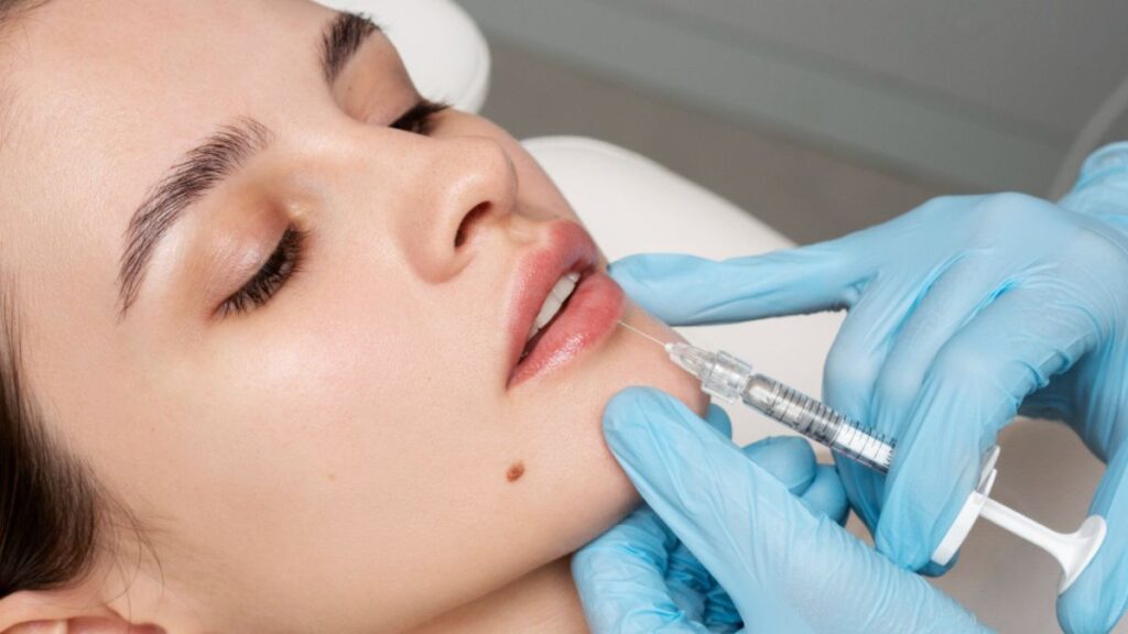 Médico aplicando preenchimento do contorno labial em paciente.