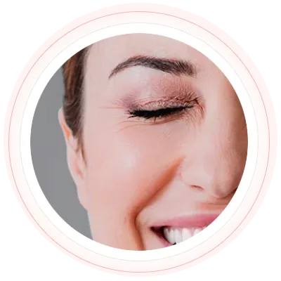 Blefaroplastia