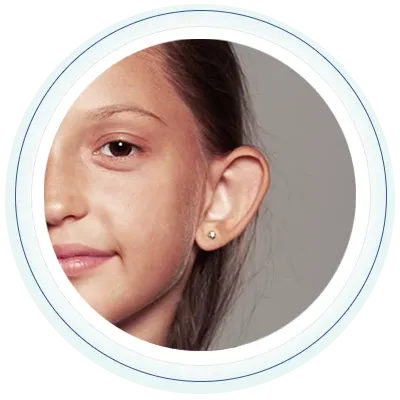 Otoplastia